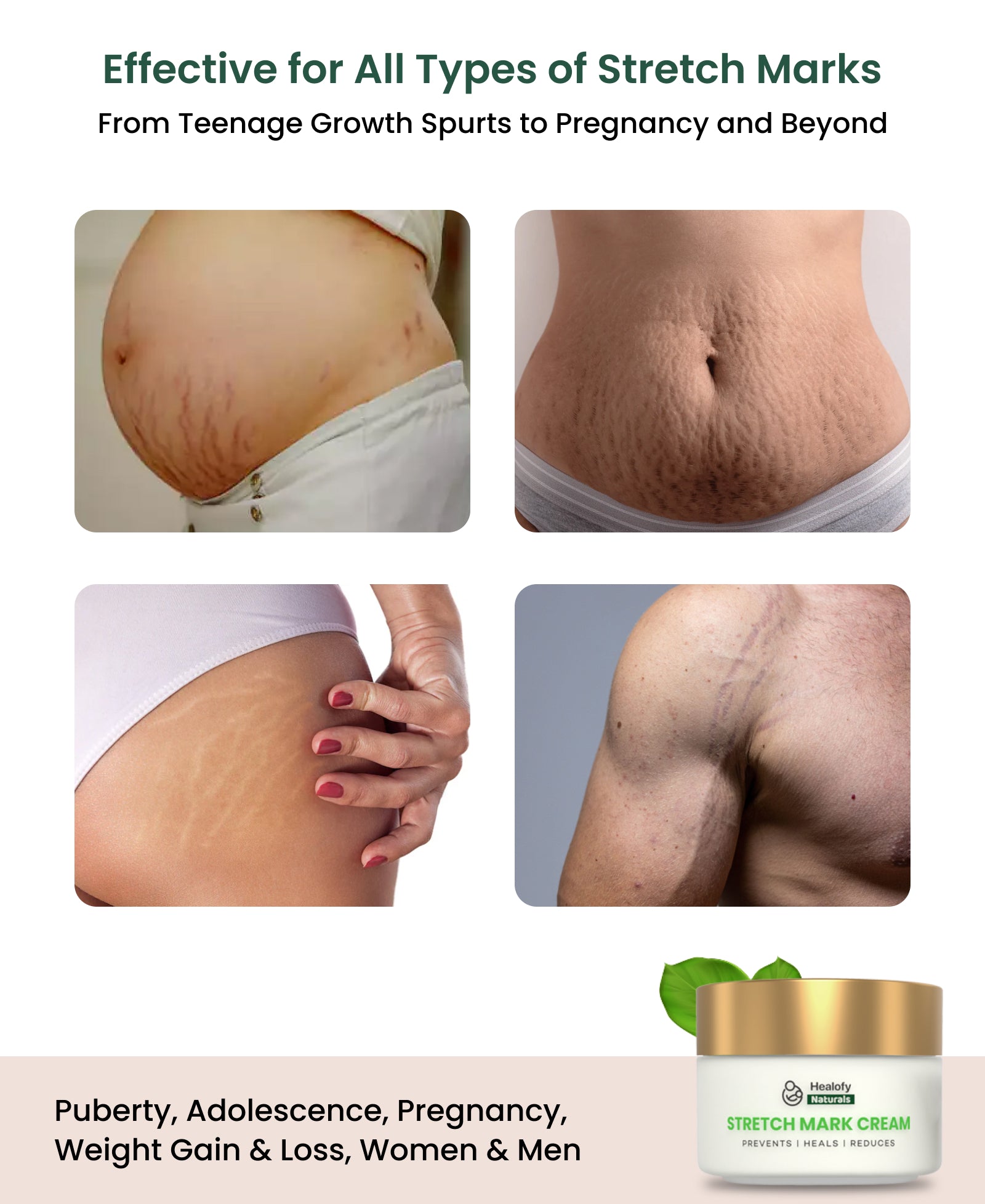 Healofy Naturals Stretchmarks Cream | Fades Stretchmarks in 28 Days with Natural Ingredients