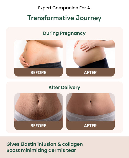 Healofy Naturals Stretch Marks Serum