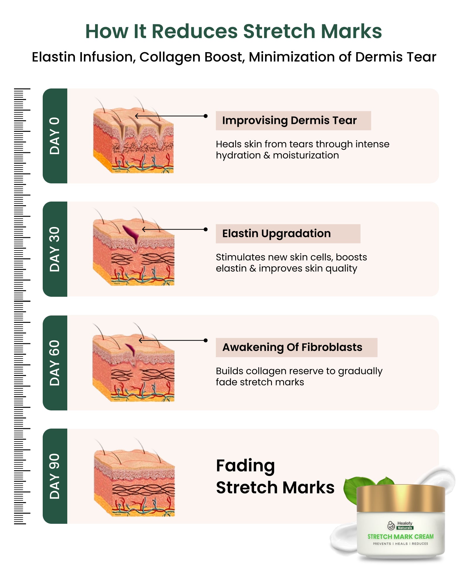 Healofy Naturals Stretchmarks Cream | Fades Stretchmarks in 28 Days with Natural Ingredients