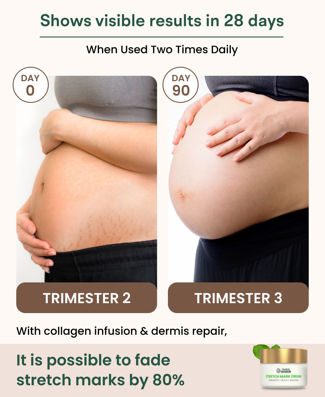 Healofy Natural Stretchmarks Cream - Pregnancy & Breastfeeding Safe